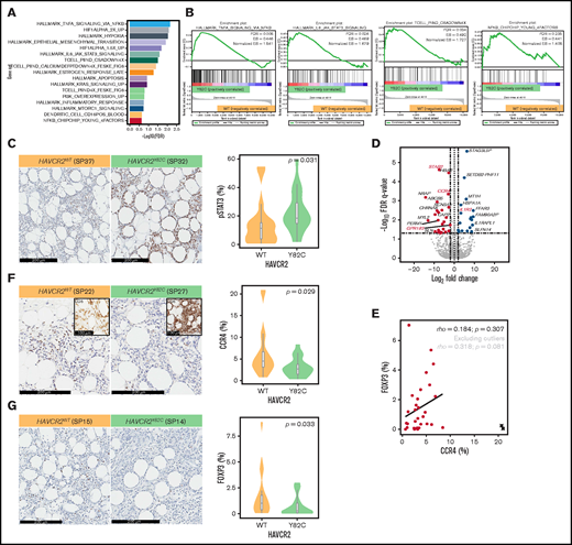 GSEA and DEGs between HAVCR2Y82C and HAVCR2WT SPTCLs. (A) Significantly enriched gene sets in HAVCR2Y82C SPTCLs and their NES are shown. (B) Most enriched gene set in HAVCR2Y82C SPTCLs were associated with increased inflammatory responses. (C) Higher number of pSTAT3-positive cells characterizes HAVCR2Y82C SPTCLs. (D) Volcano plot highlighting 52 genes differentially expressed according to HAVCR2 genotype. (E) CCR4 and Foxp3 positivity was assessed by using IHC. Correlation plot showing percentages of CCR4- and Foxp3-positive cells; circled cross indicates outlier results. (F and G) HAVCR2WT SPTCLs had a significantly higher number of CCR4-positive cells and Foxp3-positive cells compared with HAVCRY82C SPTCLs (Mann-Whitney U test).