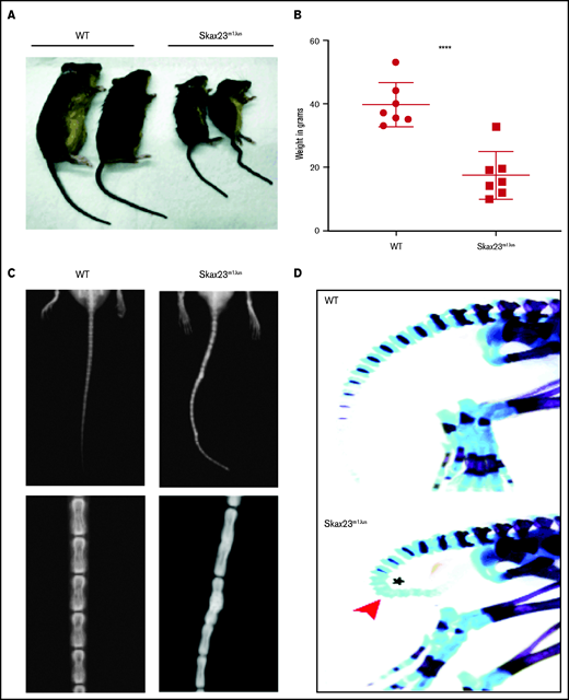 Skax23m1Jus mice grow poorly and exhibit a kinky tail defect caused by delayed endochondral ossification. (A) The Skax23m1Jus mouse mutant was generated and identified as part of the chromosome 11 balancer mutagenesis screening at the Mouse Mutagenesis and Phenotyping Center for Developmental Defects at Baylor College of Medicine in Houston (http://www.mouse-genome.bcm.tmc.edu). Skax23m1Jus was identified as a dominant mutant with a kinky tail phenotype and poor growth. (B) Mutant adult mice (n = 7) were significantly smaller than WT (n = 7) ****P < .0001, WT vs Skax23m1Jus mice. (C) Radiographic analyses of adult mice show abnormal fusion and hypertrophy of tail bone joints in Skax23m1Jus mice when compared with WT littermates (low-power view, 1.5-2×; high-power view, 3×). (D) Wholemount staining of newborn mice using Alcian blue (for cartilage) or Alizarin red (for bone) was performed. Skax23m1Jus newborn mice had kinky tails (arrowhead) with delayed endochondral ossification (asterisk).