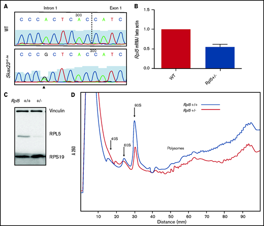 Rpl5 intronic mutation identified in Skax23m1Jus mice leads to decreased mRNA, protein levels, and polysome defects. (A) Chromatogram of reverse-strand partial sequences of exon 1 and intron 1 of Rpl5 showing the heterozygous mutation (triangle) at the sixth nucleotide in intron 1. The exon-intron junction is indicated by the dotted line. (B) RT-qPCR showed a ∼50% reduction in Rpl5 mRNA in the Rpl5+/− mice when compared with WT ** P< .01. (C) Western blot analysis with vinculin and RPS19 used as loading controls showed reduced levels of RPL5 protein in Rpl5+/− mice when compared with WT. (D) Results from 3 separate experiments indicate Rpl5+/− mice have reduced 60S subunits, 80S ribosomes, and polysomes, consistent with Rpl5 haploinsufficiency.