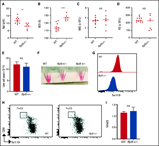 Rpl5+/− newborn mice have macrocytic anemia. Newborn mice (days 1-3) were euthanized and the blood counts analyzed (WT, n = 10; Rpl5+/−, n = 7). Rpl5+/− mice exhibited evidence of anemia (A) with significantly lower hemoglobin (Hb) levels and (B) macrocytosis, as demonstrated by an elevated mean corpuscular volume (MCV). There was no significant (NS) difference in WBC (C) or platelet (PLT) counts (D) between Rpl5+/− and WT mice. The horizontal line represents the median value for each group. **P < .01; ****P < .0001. Newborn livers (days 1 and 2) were isolated, and flow cytometry was performed to analyze erythroid differentiation. There was no difference in liver cellularity (E) but all Rpl5+/− mice had paler livers (F) with decreased Ter119 mean fluorescence intensity (G). (H-I) There was no difference in the number of proerythroblasts (WT, n = 3; Rpl5+/−, n = 3).