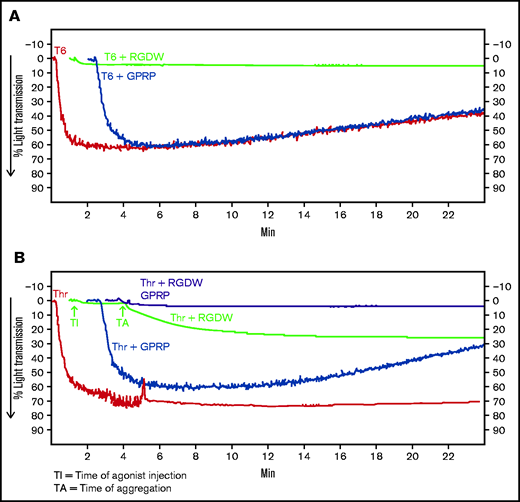 Human platelets treated with the peptide RGDW show a fibrin-mediated delayed wave (DW) of increased light transmission when activated with Thr; fibrinogen enhances the DW, and platelet activation is required for interaction with polymerized fibrin. Washed platelets (2 × 108/mL) were treated with 150 μM RGDW and/or the fibrin polymerization inhibitor Gly-Pro-Arg-Pro (GPRP) for 20 minutes at room temperature and then activated with either (A) 25 μM of a Thr PAR-1 receptor activating peptide (SFLLRN; T6) or (B) 0.2 U/mL Thr in an aggregometer cuvette. Changes in light transmission were measured at 37°C with stirring. (C) Quantitation and statistical analysis of the corresponding maximal change in light transmission (ΔLT) of the T6- or Thr-induced initial wave (<2 minutes after agonist injection) in the presence or absence of RGDW (left panel), and Thr-induced DW (>2 minutes after agonist injection), presented as mean ± SD. Where indicated, samples were treated with human fibrinogen (10, 50, and 100 µg/mL; red dots), GPRP (5 µM; green dots), or mAbs 6D1 or 6F1 (both at 10 µg/mL; blue dots). Data are presented as mean ± SD. Statistical analyses were performed using Student t test between samples tested in the same experiments with and without the indicated intervention (color-coded). *P < .05; ****P < .0001. ns, nonsignificant. (D) In parallel studies, the reaction was stopped at the indicated times by adding one-third volume of 3× sodium dodecyl sulfate (SDS) sample buffer. Samples were subjected to SDS-polyacrylamide gel electrophoresis under reducing conditions and immunoblotted with an mAb specific for the fibrinogen γ-chain. (E) Addition of fibrinogen at 10 µg/mL (blue tracing), 50 µg/mL (purple tracing), 100 µg/mL (black tracing) enhanced the DW. (F) Effect of added fibrinogen on the time to DW onset. Fibrinogen at the indicated concentrations was added to washed platelet samples treated with 150 μM RGDW in an aggregometer cuvette at 37°C with stirring. After 60 seconds, 0.2 U/mL Thr was added (time of injection), and the time of DW onset was recorded. Data were presented as mean ± SD. Significant differences (P < .05) between groups were estimated using Student t test. *P < .05, **P < .01. (G) Washed platelets were treated with 15 μg/mL PT25-2 for 20 minutes at room temperature. Then, soluble fibrin (100 μg/mL) was added, and the change in light transmission was monitored. All tracings and the immunoblot are representative of at least 3 independent experiments.