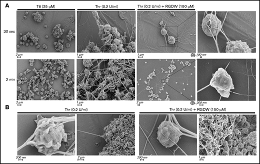 SEM demonstrates that RGDW inhibits platelet-platelet interactions, but not platelet interactions with polymerizing fibrin in the DW. Representative SEM images of washed platelets (2 × 108/mL) stimulated in the aggregometer with the indicated agonist, with or without pretreatment with 150 μM RGDW. (A) Samples fixed 30 seconds (top row) or 2 minutes (lower row) after initiation of aggregation or onset of the DW. (B) Samples fixed 4 minutes after activation with Thr alone (left 2 panels) or Thr with RGDW (right 2 panels).