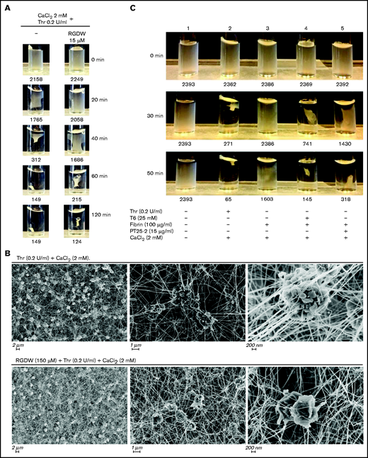 As with the DW, RGDW only partially inhibits clot retraction; αIIbβ3 activation is required for retraction of preformed fibrin. (A) Washed platelets (3 × 108/mL) were treated with the RGDW (150 µM) for 20 minutes at room temperature and then transferred to an aggregometer cuvette containing 0.2 U/mL Thr and 2 mM CaCl2 to initiate clot retraction. The area of the clot is shown underneath each photograph and expressed in square pixels. (B) SEM images of clot retraction after 15 minutes. (C) Washed platelets were untreated (sample 1) or stimulated to undergo clot retraction with the following: Thr + CaCl2 (sample 2), or soluble fibrin + CaCl2 alone (sample 3), or in combination with 15 μg/mL of the mAb PT25-2 (sample 4), or 25 μM T6 (sample 5). Photographs of the time course of clot retraction are shown. The area of the clot is shown underneath each photograph and expressed in square pixels. Data shown in panels A and C are representative of at least 3 independent experiments.