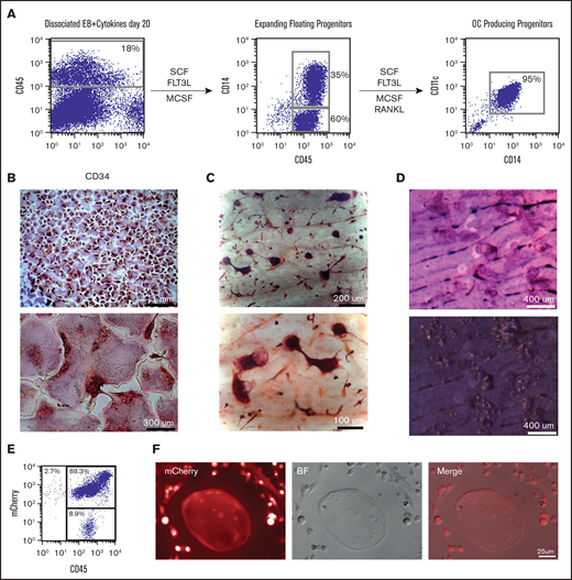 Robust generation of osteoclast progenitors (OCPs) from hESCs and mCherry hESCs. (A) After 20 days of EB differentiation in the 6-cytokine cocktail, EBs were enzymatically dissociated and analyzed for the expression of CD45 and CD34. Cells were plated back into media containing SCF, FLT3L, and MCSF. Expanded floating cells were removed from the dish and analyzed for expression of CD14. Cultures were continued in tissue culture wells with and without dentine bovine slices along with the addition of RANKL. Between 6 and 10 days after RANKL addition, wells or slices were stained for TRAcP and osteoclasts evaluated as multinucleated TRAcP positive cells. (B) TRAcP+ osteoclasts (low and high magnification) grown on tissue culture dishes and (C) on top of dentine slices. (D) Toluidine blue-stained dentine slices after OC removal identifies numerous resorption pits. (E) Zinc finger nuclease-derived ubiquitin-mCherry hESC cell line was evaluated by flow cytometry for mCherry and CD45 after 20 days in EB 6-cytokine cocktail (F) and then switched to osteoclast inducing media which lead to multinucleated mCherry+osteoclasts and mCherry+progenitors.