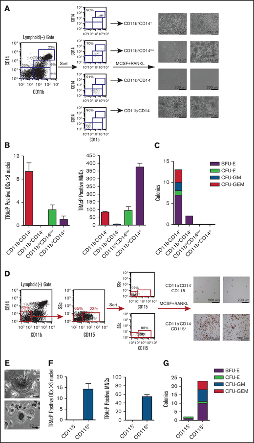 Myeloid progenitor potential of human peripheral blood cells. (A) Peripheral blood mononuclear cells (PBMCs) were analyzed in the context of CD11b and CD14 and sorted into 4 distinct populations (FACS plot are shown for 1 patient). Sorted cells were then cultured in the presence of MCSF and RANKL for 2 weeks, stained for TRAcP, and photographed at ×10 magnification (2 representative patients shown). (B) Equal numbers (10 K) from each population were cultured in the presence of MCSF and RANKL and TRAcP+ osteoclasts with 3 or more nuclei and mononuclear cells (MNCs) were counted. (C) Equal numbers of cells from each population plated into methylcellulose and scored at day 10 for BFU-E, CFU-E, CFU-GM, and CFU-GEM. (D) The DN population was dissected further by sorting CD115− and CD115+ cells within the DN gate (2 representative patients shown). 10 K of sorted cells were grown in osteoclastic conditions and stained for TRAcP (photographed at ×35 magnification). (E) Higher magnification shows examples of multinucleated osteoclasts which were enumerated in (F) as well as TRAcP+ MNCs. (G) Equal numbers of sorted cells were grown in myeloid-erythroid methylcellulose for 10 days and then colonies enumerated. BFU-E, burst-forming unit-erythroid; CFU- colony forming unit; E, erythrocyte; G, granulocyte; GEM, granulocyte, erythrocyte, and monocyte; GM, granulocyte and monocyte; M, monocyte.