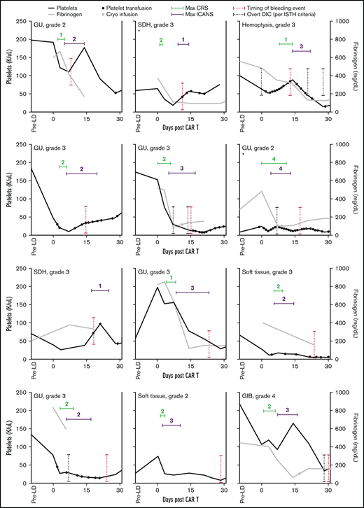 Individual bleeding events after CAR T infusion. Individual plots for each patient with bleeding events illustrating platelet and fibrinogen measurements, as well as platelet and plasma transfusion requirements during the first 30 days after CAR T infusion. Duration and maximum grade of CRS and ICANS are included. Patients are shown in sequential order based on timing of the bleeding event. Note that plots in patients without available fibrinogen measurements (n = 2) do not include gray lines. *Patients treated with a bispecific CD 19/22 CAR construct (n = 2), whereas the remaining patients (n = 10) received CD 19 CAR T therapy with axi-cel. GIB, gastrointestinal bleeding; GUB, genitourinary bleeding; SDH, subdural hematoma.