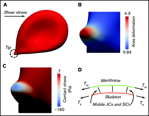 Mechanical state of an adhered RBC in shear flow. (A) An RBC locally adhered while under a shear stress of τ = 0.7 dynes/cm2. Note the encircled “adhered tip.” (B) Area deformation of the skeleton, at the adhered tip, as measured by λ1, λ2, where λi, with i = 1,2 are the 2 principal stretches in the plane of the membrane; this means that the fractional area change of the skeleton would be α = λ1λ2 − 1. Note that the area deformation of the bilipid membrane is 0. (C) The contact pressure at the adhered tip, which when negative, represents a stress that tends to pull apart the skeleton and membrane. (D) The model is that of a viscous bilipid membrane attached to the skeleton via discrete “pinning points” representing the transmembrane protein and peripheral anchoring proteins. Note that the membrane proteins are mobile within the membrane via viscous drag; hence, the skeleton may “remodel” and, thereby, alter the areal density of pinning points. Tm and Ts are the tensions in the membrane and skeleton, respectively. Details can be found in Asaro et al.12,13 SC, suspension complex.