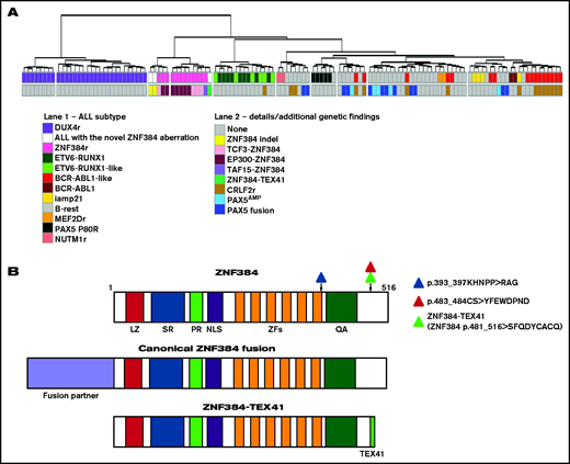 Hierarchical clustering and schematic representation of ZNF384 proteins. (A) Hierarchical clustering based on RNA-seq gene-expression data. A total of 117 B-other, 9 ETV6-RUNX1–positive, and 2 BCR-ABL1–positive ALL/MPAL cases were clustered hierarchically (vst normalization, ward.D method, and Euclidean distance linkage for hierarchical clustering) based on the expression of the most variably expressed transcripts (transcripts with standard deviation of expression ≥35% of the maximal standard deviation; n = 391). The resulting dendrogram is shown. ALL was classified as BCR-ABL1-like and ETV6-RUNX1-like based on coclustering with BCR-ABL1–positive and ETV6-RUNX1–positive ALL, respectively, in supervised HCA.6 Classification into genetically defined subtypes was based on the identification of defining genetic lesions. The cohort consists of 110 patients as reported previously,6 complemented by 7 additional patients with ZNF384 gene aberrations and available RNA-seq data. B-rest, not classified into any established subtype; iamp, intrachromosomal amplification; AMP, amplification. (B) Schematic representation of the wild-type ZNF384 protein with the positions of 3 novel aberrations and chimeric proteins encoded by canonical ZNF384 fusion and the novel ZNF384-TEX41 fusion. LZ, leucine-rich domain; NLS, nuclear localization signal; PR, proline-rich domain; QA, Gln-Ala repeat; SR, serine-rich domain; ZFs, Kruppel-type C2H2 zinc-finger domains. Adapted from Liu et al5 with permission.