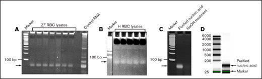 Analysis of the RBC lysates. Zebrafish (ZF) (A) and human (H) (B) RBC lysates were run on 5% native polyacrylamide gel and stained with EtBr. Arrows show a single band of nucleic acid. Double-stranded DNA size markers are indicated by “Marker.” (C) NaOH treatment of the gel-purified nucleic acid (indicated by arrow) from the zebrafish RBC lysates shows disappearance of the nucleic acid. (D) Quality of the purified RNA from zebrafish RBC lysates was checked by Omega Bioservices using a denaturing gel. Arrows indicate the purified RNA (150 nucleotides long) and the internal marker (25 nucleotides long). The standard RNA size markers are shown on the left.