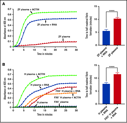 Activation of zebrafish and human plasmas by gel-purified RNA from RBC lysates. (A-B) Left graphs show increasing fibrin formation with increasing time in the kinetic coagulation assay. The curves were obtained from (A) zebrafish plasma with RNA (A) and human plasma with RNA or FXII-deficient (FXII–) (B) human plasma with RNA; both panels show plasma with Dade Actin and in the absence of RNA or Dade Actin (control). The bar graphs on the right show a significant shortening of the time to half-maximal fibrin formation (using data from the left graphs) (A) for zebrafish plasma with RNA and without RNA (control) and (B) for normal human plasma with RNA and FXII– human plasma with RNA (n = 4). The time (in minutes) was plotted against the absorbance at 405 nm at 25°C. The data were analyzed using Student t test and are shown as mean ± standard error of the mean (SEM). ****P < .0001.