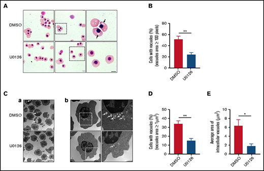 Inactivation of the ERK pathway impaired vacuole formation in human orthochromatic erythroblasts. (A) Representative cytospin images showing morphology of orthochromatic erythroblasts treated with DMSO or U0126. Black arrows indicate large vacuoles in cytoplasm. Scale bar, 5 μm. (B) Quantification of erythroblasts that harbored vacuoles with a size >100 pixels. A total of 100 cells of each group from 3 independent experiments were used for quantification. (C) Representative EM images (a and b) of orthochromatic erythroblasts treated with DMSO or U0126. White arrows indicate vacuoles. Scale bar, 5 μm. (D) Quantification of erythroblasts harboring vacuoles with a size >1 μm2. A total of 100 cells of each group from 3 independent experiments were used for the quantification. (E) Quantitative analysis of the average area of intracellular vacuoles in erythroblasts, and 100 cells of each group from 3 independent experiments were used for quantification. Data are expressed as mean ± standard deviation. *P < .05, **P < .01.
