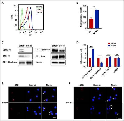 Inactivation of the ERK pathway inhibited CD71 internalization in orthochromatic erythroblasts. (A) Representative flow cytometry analysis showing the expression of CD71 on DMSO- or U0126-treated erythroblasts. (B) Quantitative analyses of CD71 surface expression from 3 independent experiments. (C) Representative western blot showing CD71 expression in plasma membrane, cytoplasm, and total cells on DMSO- or U0126-treated erythroblasts. Glyceraldehyde-3-phosphate dehydrogenase (GAPDH) served as the loading control. (D) Quantitative analyses of CD71 protein levels from 3 independent experiments. (E) Representative immunofluorescence images showing localization of CD71 in DMSO-treated erythroblasts. White arrows indicate internalization of CD71. (F) Representative immunofluorescence images showing localization of CD71 in U0126-treated erythroblasts. White arrowheads indicate CD71 on cell membrane. Scale bar, 10 μm. Data are expressed as mean ± standard deviation. ***P < .001. n.s., not statistically significant.