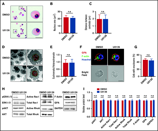 Inactivation of the ERK pathway did not affect the chromatin condensation, nuclear polarization, or enucleosome formation. (A) Representative cytospin images showing morphology of erythroblasts treated with DMSO or U0126. Blue dotted lines depict the outline of the cells, red dotted lines depict the outline of the nucleus, yellow asterisks indicate the central of the cell or nucleus, and yellow lines indicate the distance between cell and nucleus centroids. Scale bar, 5 μm. (B) Quantitative analyses of the nucleus area from cytospin images. (C) Quantitative analysis of the centroid distance between cell and nucleus. (D) Representative EM images showing morphology of the erythroblasts treated with DMSO or U0126. Green dotted lines depict outline of the nucleus, and red dotted lines depict the euchromatin. Scale bar, 5 μm. (E) Quantitative analysis of the ratio of euchromatin/heterochromatin. (F) Representative immunofluorescence images showing F-actin spot (enucleosome) in erythroblasts treated with DMSO or U0126. White arrows indicate enucleosome. Scale bar, 5 μm. (G) Quantitative analyses of the erythroblasts that contain the enucleosome. A total of 100 cells of each group from 3 independent experiments were used for quantification. (H) Representative western blot showing pAKT, AKT, active Rac1, total Rac1, active RhoA, total RhoA, F-actin, and GPA expression in orthochromatic erythroblasts treated with DMSO or U0126. Glyceraldehyde-3-phosphate dehydrogenase (GAPDH) served as the loading control. (I) Quantitative analyses of pAKT, AKT, active Rac1, total Rac1, active RhoA, total RhoA, F-actin, and GPA protein levels from 3 independent experiments. Data are expressed as mean ± standard deviation. n.s., not statistically significant.