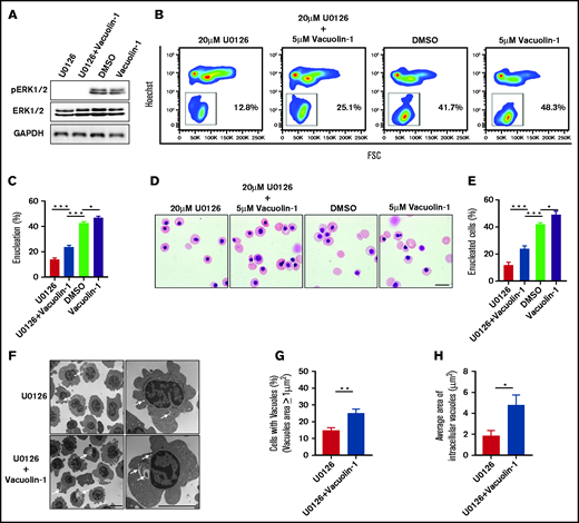 Rescue of U0126-induced enucleation impairment by vacuolin-1. (A) Representative western blot showing changes in pERK1/2 and ERK1/2 expression under various conditions as indicated. Glyceraldehyde-3-phosphate dehydrogenase (GAPDH) served as the loading control. (B) Representative flow cytometry analyses of enucleation under various conditions as indicated. (C) Quantitative analyses of enucleation from 3 independent experiments. (D) Representative cytospin images of orthochromatic erythroblasts under various conditions as indicated. Scale bar, 10 μm. (E) Quantitative analyses of enucleation from cytospin images. A total of 100 cells of each group from 3 independent experiments were used for quantification. (F) Representative EM images of orthochromatic erythroblasts under different conditions as indicated. White arrows indicate vacuoles. Scale bar, 5 μm. (G) Quantification of erythroblasts harboring vacuoles with a size >1 μm2. A total of 100 cells of each group from 3 independent experiments were used for the quantification. (H) Quantitative analysis of the average area of intracellular vacuoles in erythroblasts. A total of 100 cells of each group from 3 independent experiments were used for quantification. Data are expressed as mean ± standard deviation. *P < .05, **P < .01, ***P < .001. FSC, forward scatter.