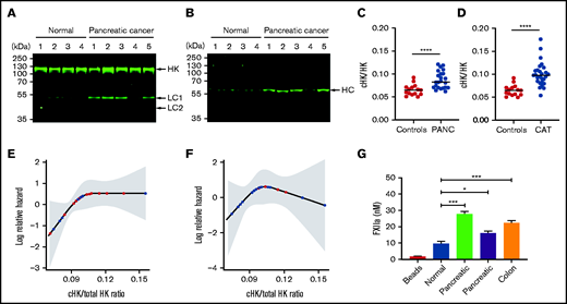 Increased levels of cHK in plasma from patients with cancer. (A) HK cleavage in plasma from patients with pancreatic cancer and healthy donors (normal) was determined by immunoblotting using antibody to HK domain 5. (B) The same plasmas as in (A) were analyzed using an antibody specific for the C terminus of the free HK heavy chain (HC) after reduction (HKa1; supplemental Figure 1). (C) Ratio of cHK/HK in plasma from healthy individuals and patients with pancreatic cancer (PANC) (n = 26), determined by Wes capillary immunoblotting. (D) Ratio of cHK/HK in healthy individuals and patients presenting to the cancer thrombosis clinic (n = 21) with symptoms of VTE, as determined by Wes capillary immunoblotting. Bars represent means ± SEM. ***P < .001, ****P < .0001, unpaired Student t test with Welch’s correction. (E) Log relative hazard of VTE or death vs cHK/total HK ratio from the Cox proportional hazard modeling of patients with different types of cancer. Each red dot indicates a VTE or death event, and each black dot indicates a censored event; the shaded area is the 95% confidence interval for the log hazard. (F) Log relative hazard of VTE only (censored at death) vs cHK/total HK ratio from the Cox proportional hazard modeling of patients with different types of cancer. Each red dot indicates a VTE event, and each black dot indicates a censored event; the shaded area is the 95% confidence interval for the log hazard. (G) FXII activation by EVs immunopurified from a healthy donor or from patients with pancreatic or colon cancer. Data are means ± SEM. *P < .05, ***P < .001, 1-way ANOVA with a unpaired Student t test with multiple comparisons.