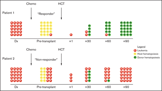GVL kinetics in molecular responders vs nonresponders.
