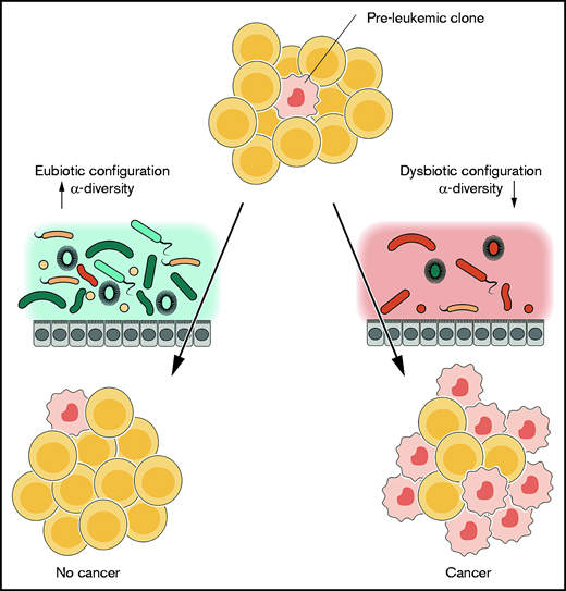 The contribution of the GM to the multistep developmental hypothesis for leukemogenesis. In intrinsically predisposed subjects, preleukemic clones may arise and, according to the hypothesis, their development may be influenced by environmental stimuli. The GM can represent one of these, serving as an additional hit in the multistep process, as was demonstrated in patients at the time of diagnosis (right). Conversely, an “intact” GM and/or the absence of interaction with common pathogens may protect genetically predisposed subjects (left).