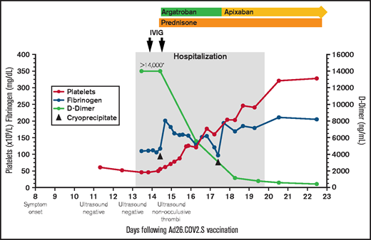 Platelet count, fibrinogen, D-dimer, and treatment over time. The X-axis indicates the days following Ad26.COV2.S vaccination. The left Y-axis indicates platelet count and fibrinogen concentration; the right Y-axis indicates D-dimer concentration. Normal range for platelet count (140-450 ×109/L), fibrinogen (202-430 mg/dL), d-dimer (<500 ng/mL). *>14 000 is the maximum d-dimer value reported by our laboratory. Hospitalization, the gray-shaded column, indicates the time from presentation to our emergency department until discharge from the hospital. IVIG (1 g/kg) was administered to increase platelet count to allow for safe initiation of anticoagulation. Cryoprecipitate (first dose 10 units; second dose 5 units) was given to improve fibrinogen levels to allow for safe initiation of anticoagulation. Prednisone 1 mg/kg per day with taper. Therapeutic argatroban was dosed for target activated partial thromboplastin time of 60 to 80 seconds. Apixaban 10 mg twice daily ×7 days followed by 5 mg twice daily.