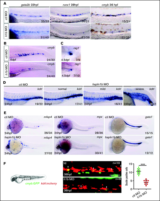 Hapln1b is necessary for the specification of HSPC from the hemogenic endothelium. (A) Gata2b, runx1, and cmyb ISH in control MO, or hapln1b MO-injected embryos (injected at 3 ng throughout, unless otherwise stated). (B) ISH expression of cmyb, in control MO–, or hapln1b MO–injected embryos. (C) Rag1 expression in the thymus after control MO or hapln1b MO injection. (D) ISH expression of kdrl in control MO– or hapln1b MO–injected embryos. Hapln1b morphants displayed 3 phenotypes: normal, mild, and severe. (E) ISH expression of mfap4, mpx, and gata1 in control MO– or hapln1b MO–injected embryos. H1b, hapln1b. (F) Imaging double-transgenic kdrl:mCherry/cmyb:GFP embryos at 36 hpf. Bar represents 50 µm. Control (ctl) MO vs hapln1b mRNA injected, P < .0001. Student unpaired t-test.
