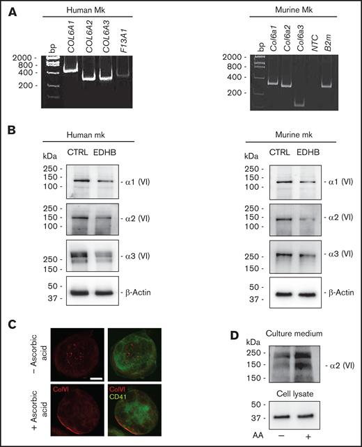 Human and murine Mks express collagen VI. (A) RT-PCR of COL6A1, COL6A2, and COL6A3 messenger RNAs in human (left panel) and murine (right panel) Mks. Factor XIII (F13A1) and β2-microglobulin (B2m) were used as positive controls. The migration of the DNA size marker (bp) is shown. (B) Western blot for α1, α2, and α3 chains of collagen VI in human (left panel) and murine (right panel) Mks. Membranes were probed with monoclonal antibodies raised against each single chain. β-Actin was used as a loading control. Where indicated, Mks were treated with 100 μM the prolyl-4-hydroxylase inhibitor EDHB. In parallel, Mks were treated with vehicle alone (0.1% ethanol) as control. (C) Confocal microscopy immunofluorescence of WT mouse Mks stained with a polyclonal antibody against collagen VI (red) and a monoclonal antibody against CD41 (green). Where indicated, Mks were cultured in the presence of 50 μg/mL ascorbic acid for 48 hours. Scale bar, 10 μm. (D) Western blot analysis of collagen VI secretion in the culture medium by Mks. Differentiated WT Mks were cultured for 48 hours in the absence or presence of 50 μg/mL ascorbic acid (AA). Then, the culture medium was collected, centrifuged, and resolved using sodium dodecyl sulfate polyacrylamide gel electrophoresis under reducing and denaturing conditions. Membranes were probed with a monoclonal antibody recognizing collagen VI α2 chain. CTRL, control; NTC, no template control; VI, collagen VI.