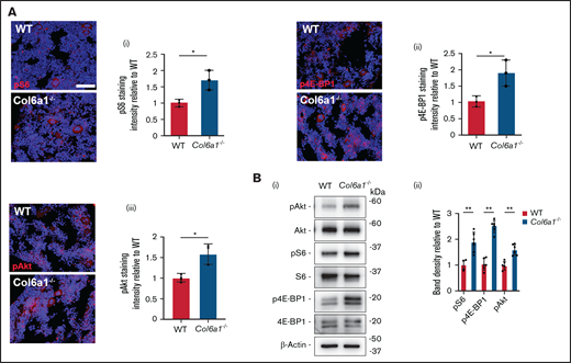 Col6a1−/− Mks and platelets display increased mTORC1 signaling. (A) In situ staining of phosphorylated (p)S6 protein (i), p4E-BP1 protein (ii), and pAkt (iii) in WT and Col6a1−/− CD41+ BM Mks. Staining intensities were quantified and expressed relative to WT. A minimum of 40 Mks were analyzed per section. Data are mean ± SD (n = 3). Student t test. (Bi) Western blot of pAkt, pS6, and p4E-BP1 in WT and Col6a1−/− platelets. Total Akt, total S6, total 4E-BP1, and β-actin were used as loading controls. (Bii) Band densities were quantified and expressed relative to WT. Data are mean ± SD (n = 6). Student t test. *P < .05; ** P < .01.