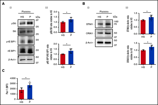 Increased STIM1 and ORAI1 expression in platelets derived from patients affected by collagen VI–related disorders. (Ai) Representative western blot of phosphorylated (p) S6 protein and 4E-BP1 protein in peripheral blood platelets of healthy subjects (HS; n = 3) and patients (P) with Bethlem myopathy/UCMD (n = 5). (Aii) Band densities were quantified and expressed relative to HS. Data are mean ± SD. Student t test. (Bi) Representative western blot of STIM1 and ORAI1 protein expression in peripheral blood platelets from HS (n = 3) and P with Bethlem myopathy/UCMD (n = 5). (Bii) Band densities were quantified and expressed relative to HS. Data are mean ± SD. Student t test. (C) Flow cytometry analysis of integrin αIIbβ3 activation (PAC-1 antibody binding) in peripheral blood platelets from HS (n = 3) and P with Bethlem myopathy/UCMD (n = 5) after stimulation with thrombin (0.5 U/mL). Data are mean ± SD. Student t test. ▵, patient 1/F; ▪, patient 2/M; ●, patient 3/M; ▾, patient 4/F; ▴, patient 5/F. Student t test. *P < .05. MFI, mean fluorescence intensity.