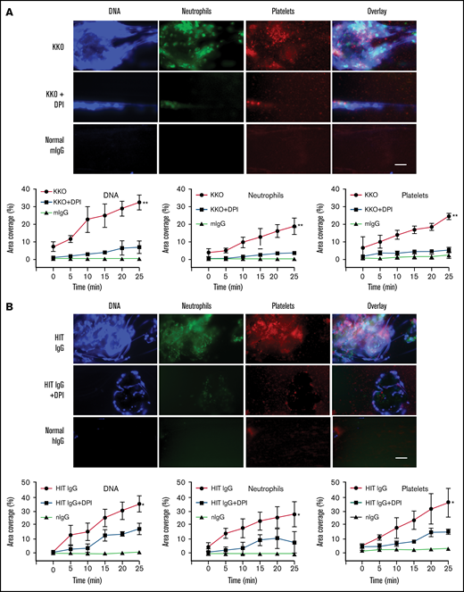 Inhibiting ROS abrogates clot formation and release of NETs under flow conditions. (A) Representative fluorescent images of whole blood treated with isotype control and heparin, or KKO and heparin plus vehicle control or DPI. Extracellular DNA (Sytox, blue), neutrophils (anti-CD15 AF594, green), and platelets (anti-CD41 V450, red). Quantification of area coverage of extracellular DNA, neutrophils, and platelets from KKO-induced thrombi with and without DPI. Scale bar, 50 µm. (B) Whole blood treated with normal human IgG (hIgG) and heparin or a representative HIT IgG and heparin plus vehicle control or DPI. Staining and quantification as described in panel A. Scale bar, 50 µm. Data expressed as mean plus or minus standard deviation (SD) (n = 3). *P < .05, **P < .01, and ****P < .0001 by 1-way ANOVA with Tukey correction for multiple comparisons.