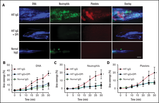 Neutrophil-targeted ROS inhibition blocks NETs and thrombosis in whole blood. Neutrophil-depleted blood was reconstituted with autologous neutrophils pretreated with vehicle control or DPI, then treated with normal IgG or HIT IgG plus heparin. (A) Representative fluorescent images showing extracellular DNA (Sytox, blue), neutrophils (anti-CD15 AF594, green), and platelets (anti-CD41 V450, red). Quantification of area coverage of (B) DNA, (C) neutrophils, and (D) platelets under different treatment conditions. Scale bar, 50 µm. Data expressed as mean plus or minus SD (n = 3). *P < .05; ns, not significant, by 1-way ANOVA with Tukey correction for multiple comparisons.