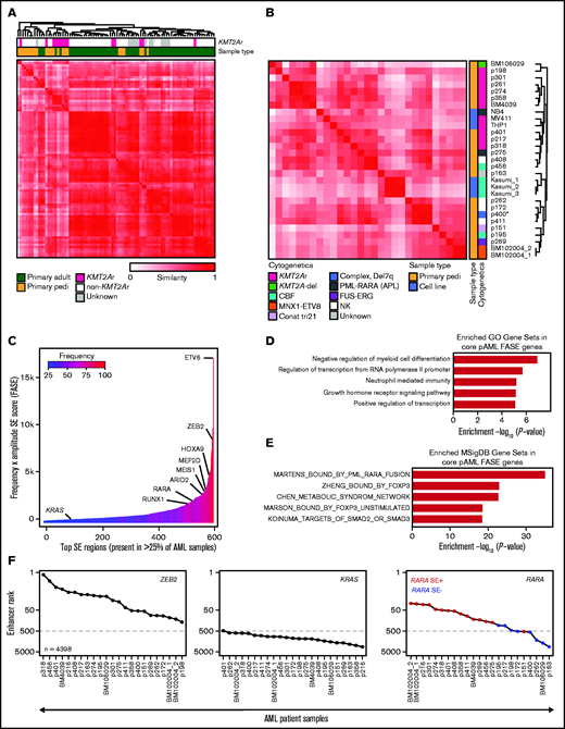 The SE landscape of pAML. (A) Similarity of primary pAML and adult AML patient samples by unsupervised hierarchical clustering of H3K27ac signal at consensus SE regions. (B) Similarity of pAML cell lines and samples by unsupervised hierarchical clustering of H3K27ac signal at consensus SE regions. Cytogenetic and molecular features depicted for each cell line and sample. Notes: replicates of the cell line Kasumi1 and the sample BM102004 were included (denoted “_1,” “_2,” and “_3”). “CBF” = core-binding factor, “Const tri 21” = a patient with trisomy 21 presenting with transient myeloproliferative disorder, and “NK” = normal karyotype. (C) Core consensus SE regions ranked according to the product of frequency and amplitude of H3K27ac signal (FASE). Consensus SE regions were defined as SE regions present in >25% of samples. (D-E) Core pAML SE-associated genes compared with known Gene Ontology (GO) signatures (D) and MSigDB C2 curated gene sets (E). Gene sets are represented by strength of significance as depicted by –Log10(P-value). (F) Enhancer ranking of three core SE-associated genes across all pAML samples. RARA SE status defined by red (present) or blue (absent) in the right panel.