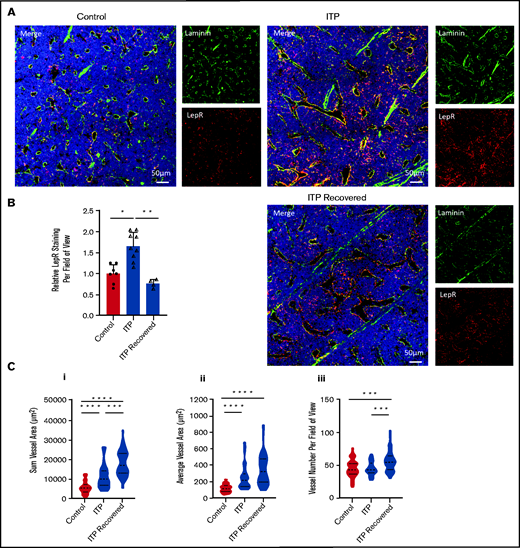 Sustained ITP remodels the BM microenvironment. ITP progression was associated with blood vessel structural changes and reversible changes in stromal cell number. Mice were treated with IgG (control) or anti-CD41 (ITP) for 4 weeks. An additional group of ITP mice were allowed to recover for an additional 4 weeks after the last injection of anti-CD41, during which platelet count returned to normal by day 18 (ITP recovered group). All data shown from controls and mice with ITP are representative of 3 independent experiments; the data from ITP recovered mice is representative of 1 independent experiment. (A) Representative confocal images of control, ITP, and ITP recovered diaphysis BM from WT femurs. (B) Relative numbers of LepR+ stromal cells were inferred by comparing total LepR staining between groups. Staining was quantified by exporting the LepR channel images as TIFF images and quantifying total staining relative to controls using ImageJ software (n = 4-9 mice; data are mean ± SD, with an average of 10 images analyzed per mouse). Control vs ITP *P = .018, control vs ITP recovered P = .91, ITP vs ITP recovered **P = .0021. P values were calculated by using a Kruskal-Wallis test with Dunn’s multiple comparison test. (C) Vessel analysis showing (i) sum vessel area (control vs ITP ****P < .0001, control vs ITP recovered ****P < .0001, ITP vs ITP recovered ***P = .0001), (ii) average vessel area (control vs ITP ****P < .0001, control vs ITP recovered ****P < .0001, ITP vs ITP recovered P = .066), and (iii) vessel number (control vs ITP P > .99, control vs ITP recovered ***P = .0008, ITP vs ITP recovered ***P = .0007). Vessel information was quantified using StrataQuest analysis software (TissueGnostics). P values were calculated by a Kruskal-Wallis test with Dunn’s multiple comparison test (n = 44-55 images). Violin plots show median values and upper and lower quartiles, with an average of 10 images analyzed per mouse. All data are shown as mean ± SD.
