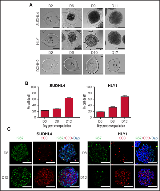 B-NHL spheroids obtained by using the cellular capsule technology. (A) Representative images of cell growth in alginate capsule shells over time for the various cell lines. Scale bar, 100 µm. (B) Percentage of SUDHL4 and HLY1 cell death measured after shell dissolution and spheroid dissociation at 6, 8, and 12 days after encapsulation. To evaluate cell death, propidium iodide (PI) (10 µg/mL) was added to the cell suspension and PI fluorescence was analyzed by flow cytometry (n = 3). (C) Immunostaining showing the repartition of proliferating and apoptotic cells in SUDHL4 and HLY1-derived spheroids at 8 or 12 days post-encapsulation. Five micrometers thick sections were stained with anti-Ki67 (Ki67, in green) and anti-cleaved caspase 3 (CC3, in red) to identify proliferating and dead cells, respectively. Nuclei are depicted in blue (Dapi staining). Scale bar, 100 µm.