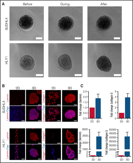B-NHL spheroids are cohesive and express extracellular matrix. (A) Pictures showing the maintenance of SUDHL4 and HLY1 spheroids after capsule dissolution by incubation in Phosphate Buffered Saline (PBS) containing 1 mM EGTA. Scale bar, 100 µm. (B) Immunostaining showing the expression of extracellular matrix in cells cultured in suspension (2D) or in spheroids (3D). Extracellular matrix components were visualized by staining with anti-pan Laminin and anti-Collagen I antibodies on 5µm thick sections of spheroids embedded in paraffin. Nuclei are depicted in blue. Scale bar, 50 µm. (C) RT-qPCR revealing the upregulation of LAMC1 and COL1A expression in SUDHL4 and HLY1 cultured in 3D compared with 2D (n = 3).