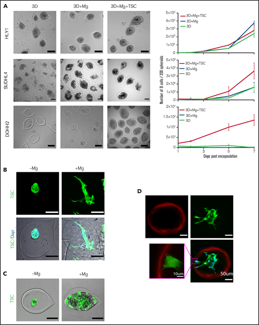 The establishment of a stromal network is necessary to reproduce stromal-dependent B-NHL cell growth. (A) Effect of Matrigel (Mg) and TSC on spheroid growth. Left panel, representative images of spheroids obtained from B cells encapsulated alone (3D) or with Mg (3D+Mg) or with Mg+TSC (3D+Mg+TSC) at D7 (HLY1), D6 (SUDHL4), or D10 (DOHH2) of culture. Scale bar, 200 µm. Right panel, the B cell number was evaluated over time in the different conditions (n = 3). (B) TSC network needs Mg to be established. Left, example of GFP-TSC encapsulated without Mg and B-cells. Right, example of TSC encapsulated with Mg but without B-cells. TSC were visualized in green by stable expression of GFP, and nuclei were stained in blue with Hoechst 33252. Capsules were imaged 3 days after encapsulation. Images were maximum intensity projection from z-stacks. Scale bar, 100 µm. (C) TSC network is necessary to induce DOHH2 spheroid growth. DOHH2 cells were coencapsulated with TSC-GFP with or without Mg for 10 days. TSC were visualized in green by stable expression of GFP. (D) TSC/Mg interaction. GFP-TSC were encapsulated alone in the presence of Mg. After 3 days in culture, capsules were fixed and immunofluorescence was performed. Mg and TSC were visualized by staining with anti-human pan laminin (in red) and anti-GFP (in green), respectively. Nuclei were counterstained in blue with Hoechst 33258. Images were maximum intensity projection from z-stacks. Scale bar, 50 µm. Yellow square is a crop showing the anchoring of TSC on Mg coating. Scale bar, 10 µm.