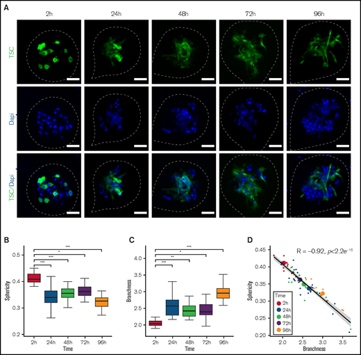 Self-organization of the stromal network. (A) Representatives images of capsules containing DOHH2 with Mg and GFP-TSC at different culture time point. After fixation, 10 to 18 spheroids for each time point were placed in an Universlide. Images shown are Z-projections. TSC are shown in green and all the analyses were performed on green signal exclusively. Nuclei of DOHH2 and TSC cells were counterstained in blue with Hoechst 33258. The edges of the capsule are depicted by white dashed lines. Scale bar, 50 µm. (B-C) Sphericity and branchness indexes of green particles contained in spheroids at different times after encapsulation, respectively. To determine significant differences, an analysis of variance was performed (*P < .05, **P < .01, ***P < .001). (D) Correlation of sphericity and branchness. For each time point, small dots represent individual spheroids whereas big dots represent the average values of all spheroids for a given time point. Pearson correlation coefficient (R) was calculated using R software. The black line represents the regression line and the gray area represents the 95% confidence interval of the linear regression.