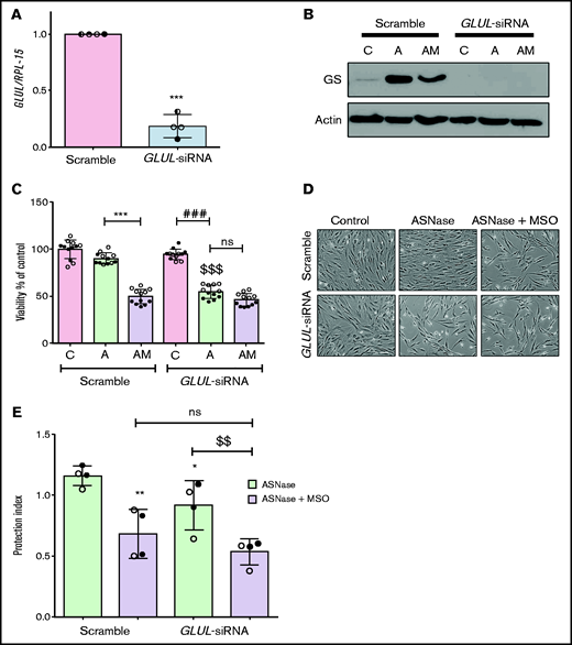 Glutamine Synthetase activity is required in both MSCs and leukemia cells for optimal protection from l-asparaginase. (A) ALL-MSCs were transfected with scramble (kept at 1) or GLUL-siRNA (see Materials and Methods), and the expression of GLUL mRNA was evaluated after 48 hours. Means ± SD of 4 independent experiments performed with MSCs from 4 patients (UPN#12-14-15-16, supplemental Table 2A) are shown. ***P < .001. (B-D) Scramble-transfected or GLUL-silenced ALL-MSCs were treated for 72 hours with l-asparaginase (lane A) or with l-asparaginase + methionine-l-sulfoximine (lane AM). (B) Expression of GS protein. A representative experiment is shown with actin used for loading control. (C) Cell viability. Data are expressed as percentage of the viability of untreated scramble-transfected cells and are means ± SD of 12 independent experiments performed with MSCs from 2 patients (UPN#14-15, supplemental Table 2A). ***P < .001, scramble transfected cells treated with l-asparaginase vs scramble transfected cells treated with l-asparaginase + methionine-l-sulfoximine; ###P < .001 l-asparaginase-treated GLUL-silenced cells vs control GLUL-silenced cells; $$$P < .001 vs l-asparaginase-treated scramble transfected cells. (D) Representative images of cell cultures treated as in panel C (bar = 100 μm). (E) RS4;11 cells were treated for 48 hours with l-asparaginase (ASNase,1 U/ml) in monoculture or in direct contact with scramble-transfected or GLUL-silenced MSCs in the absence or in the presence of methionine-l-sulfoximine (MSO), and the protection index was calculated. Data are means ± SD of 4 independent experiments performed with MSCs from 2 different patients (UPN#12-16, supplemental Table 2A). *P < .05, **P < .01 vs scramble-transfected cells treated with ASNase alone; $$P < .01 GLUL-silenced cells treated with ASNase alone vs GLUL-silenced cells treated with ASNase + MSO. For panels A, C, and E, in each panel different symbol identifies MSCs from an individual donor.