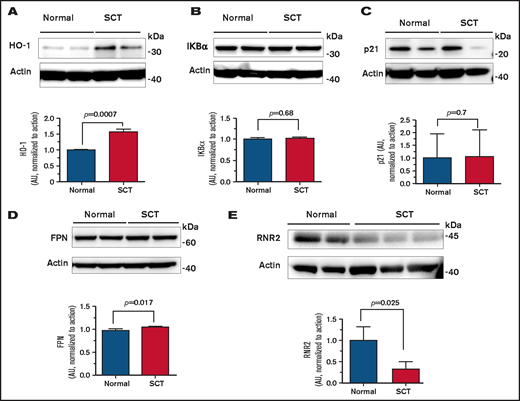 Expression of HO-1, IKBα, p21, FPN, and RNR2 in SCT PBMCs. Cell lysates from activated PBMCs obtained from individuals with SCT and normal control subjects were resolved on 4% to 12% Bis-Tris gel and probed with antibodies against HO-1 (A), IKBα (B), p21 (C), FPN (D), and RNR2 (E). β-actin was used as loading control. Results were quantified by using ImageQuant Software (Cytiva, Marlborough, MA). Bars represent 2 independent experiments. The blots show 2 representative SCT and control samples (except RNR2, where 3 SCT samples are shown). Total number of samples analyzed and quantified were 4 HbAA (50% female) and 4 HbAS (75% female) (panels A-D) and 4 HbAA (25% female) and 4 HbAS (100% female) (panel E). Data are shown as mean ± standard deviation. P values were calculated by using the Student t test.