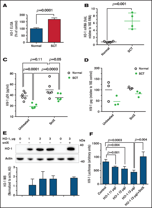 Elevated expression of HO-1 is critical for HIV-1 inhibition. (A) Upregulated HO-1 levels in SCT PBMCs. PBMCs (4 HbAA, 24% female; 4 HbAS, 100% female) were lysed, and HO-1 expression was measured in lysates by using an enzyme-linked immunosorbent assay (ELISA) from 4 control and 4 SCT PBMCs. (B) Upregulated HO-1 mRNA levels in SCT PBMCs. RNA expression of HO-1 was analyzed from 4 HbAA (50% female) and 4 SCT (75% female) PBMCs. RNA was isolated by TRIzol, reverse transcribed, and analyzed by real time PCR. Primers for 18S rRNA were used as a reference for ΔΔCt analysis. (C and D) Small molecule inhibitors of HO-1 reversed HIV-1 inhibition in SCT PBMCs. SCT PBMCs were purified and activated with phytohemagglutinin and interleukin-2 and treated with 2 μM snIX before the infection with HIV-1 (IIIB). Samples were collected 4 days’ postinfection. Supernatants were used to measure p24 by using an ELISA (panel C, 6 HbAA, 50% female; 6 HbAS, 66.7% female). Cells were collected and RNA was extracted, reverse transcribed, and analyzed with primers for HIV-1 gag gene by real-time PCR using 18S RNA as a reference (panel D, 3 HbAA, 66.6% female; 3 HbAS, 66.6% female). Data are shown as means. P values were calculated by using the Student t test. (E-F) Expression of HO-1 inhibits HIV-1. In panel E, 293T cells were transfected with the indicated amounts of HO-1–expressing vector. Cell lysates were resolved on 4% to 12% Bis-Tris gel and probed by Western blotting (WB) with antibodies against c-myc and β-actin as loading control. Results were quantified by using ImageQuant Software. Bars represent quantification from 3 independent WB experiments. Data are shown as mean ± standard deviation. In panel F, HO-1–expressing cells were further infected with HIV-1-LUC-G, and luciferase activity was measured 2 days’ postinfection. Plasmid amounts are shown in calculation for a 6-well plate to be comparable with panel E. Data are shown as mean ± standard deviation (n = 3 for each sample). P values were calculated by using the Student t test.