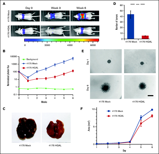 HGAL expression inhibits breast cancer cell growth, metastasis, and invasion. Mice were injected intravenously with 3 × 106 luciferase-transduced human MDA-MB-231–derived breast cancer subline 4175 cells. D-luciferin was injected intraperitoneally (150 mg/kg body weight) 15 minutes before acquiring images. Bioluminescence images were taken once per week. (A) Representative bioluminescent images of mice with subline 4175 tumors. (B) Tumor growth curve based on photon flux intensity (10 mice in each group) with significant difference between the mouse cohorts with 4175 Mock and 4175 HGAL tumors (P = .002). Mice that were not injected (background; 5 mice) served as a control for background photon flux intensity. Normalized photon flux represents tumor photon flux (luminescence intensity) at the indicated time relative to photon flux measured after cell injection on day 0 that was set to a value of 100. (C) A representative images of lungs with 4175 Mock and 4175 HGAL tumors. (D) Number of lung tumors in mice injected with 4175 Mock and 4175 HGAL cells (P = .001). (E) Representative images of in vitro 3D spheroid cell invasion in 4175 Mock and 4175 HGAL cells. Scale bar represents 200 µm. (F) Quantitative analysis of surface area of 4175 Mock and 4175 HGAL spheroids over a 6-day period (P = .0002). Experiments in panels D, E, and F were performed in triplicate and were repeated twice. ***P = .001.