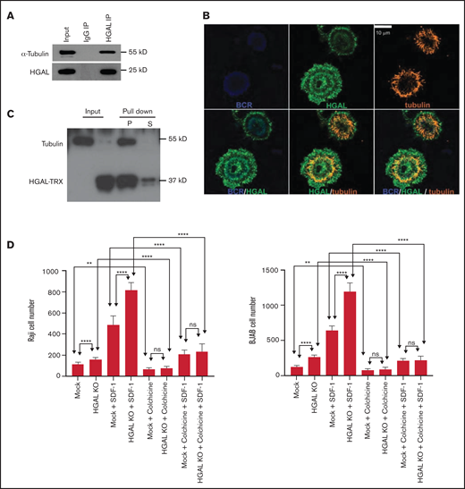 HGAL interacts with tubulin. (A) HGAL reciprocally co-immunoprecipitated (IP) with α-tubulin in Raji cells. (B) BJAB cells were seeded on planar lipid bilayer membranes coated with anti-human IgM antibody (surrogate antigen) for 30 minutes to induce B-cell synapse formation and then were analyzed. Shown are confocal microscopy images of HGAL and tyrosinated α-tubulin co-localization at 0.5 μm from the cell surface. BCR, purple; HGAL, green; tyrosinated α-tubulin, orange. (C) Co-sedimentation of recombinant HGAL tagged with thioredoxin (TRX) with isolated microtubules. (D) HGAL-mediated inhibition of lymphoma motility is dependent on tubulin. Shown are number of cells migrating in transwell experiments in the presence of the indicated stimulants and colchicine (20 nM). Means and standard deviations of 6 independent experiments are shown. **P < .01; ****P < .0001.