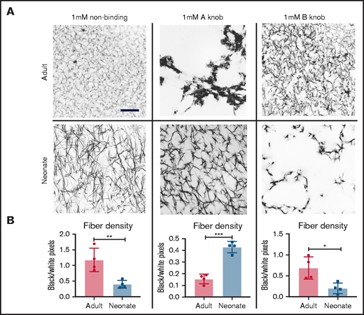 Competition assay to reveal polymerization mechanism. High concentrations of fibrin knob A and B mimetic peptides were added to neonatal and adult fibrinogen solutions before initiation of clotting with thrombin. (A) Representative images are shown from confocal microscopy imaging of clots at 63× magnification. (B) Fiber density analysis reveals significant differences between adult and neonatal clots after equivalent peptide incubation times. N = 4 per group. Scale, 10 μm. Mean fiber density ± standard deviation is reported. *P < 0.05, **P < .01, ***P < .001.