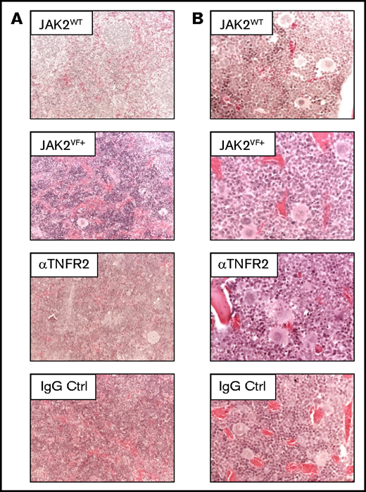 Splenic and bone marrow structure in JAK2+/VF mice after αTNFR2 treatment. (A) Representative pictures of hematoxylin and eosin–(H&E)-stained spleen sections from untreated JAK2WT(n = 1), untreated JAK2VF mice (n = 2) and JAK2+/VF mice treated with αTNFR2 antibody (n = 3) or IgG (n = 3); original magnification ×200. (B) Representative photomicrographs of H&E-stained bone marrow sections from untreated JAK2WT (n = 1), untreated JAK2VF mice (n = 2) and JAK2+/VF mice treated with αTNFR2 antibody (n = 3) or IgG (n = 3); original magnification ×400. Ctrl, control.