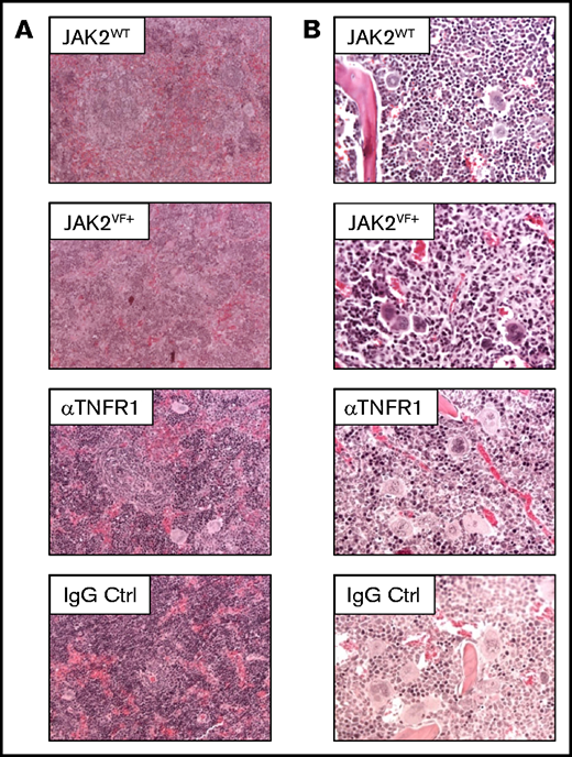 Splenic and bone marrow structure in huTNFR1ecd × JAK2+/VF mice after αTNFR1 treatment. (A) Representative photomicrographs of hematoxylin and eosin (H&E)-stained spleen sections from untreated huTNFR1ecd × JAK2+/VF mice (n = 3) and JAK2WT mice (n = 2) and huTNFR1ecd × JAK2+/VF mice treated with αTNFR1 antibody (n = 2) or IgG (n = 2); original magnification ×200. (B) Representative microphotographs of H&E-stained bone marrow sections from untreated huTNFR1ecd × JAK2+/VF mice (n = 3) and JAK2WT mice (n = 2) and huTNFR1ecd × JAK2+/VF mice treated with αTNFR1 antibody (n = 2) or IgG (n = 2); original magnification ×400.