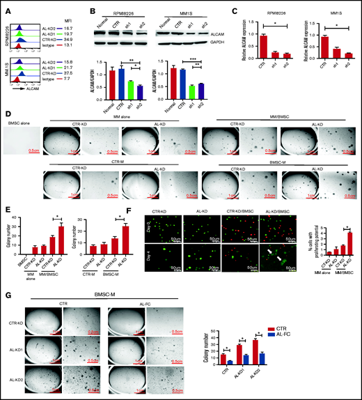 BM stroma-derived soluble factors promoted ALCAM-knocked down myeloma cell clonogenicity. (A) Flow cytometry of surface ALCAM expression in CTR-KD, AL-KD1 (shRNA sequence 1), and AL-KD2 (shRNA sequence 2) MM cells. The number indicates mean fluorescence intensity (MFI). (B) Top: western blotting of ALCAM expression in CTR-KD vs AL-KD MM cells in RPMI8226 and MM.1S; bottom: result quantification. (C) Expression of ALCAM messenger RNA in CTR-KD vs AL-KD MM cells (RPMI8226 and MM.1S) analyzed by qRT-PCR. (D) Imaging of colony formation assays in RPMI8226/BMSC cocultured condition (top) and BMSC conditioning medium (BMSC-M) (bottom). BMSCs from healthy individuals. The results are quantified in (E) left panel and right panel, respectively. The data were obtained from 3 independent experiments and shown as the mean ± SD. (F) Immunofluorescence microscopy of cells (RPMI8226-CTR vs RPMI8226-ALCAM-KD) under 3D printing. The data were obtained from 10 randomly chosen fields and shown as the mean ± SD. The results are summarized in the right panel. (G) Soft agar assay showing that soluble ALCAM-Fc (0.5 mg/mL) attenuated BMSC-M conferred RPMI8226-CTR cells and RPMI8266-ALCAM-KD clonogenicity. The data are shown as the mean ± SD. (B,E-G) Two-tailed Student t test or (C) 1-way ANOVA with multiple comparisons. *P < .05; **P < .01; ***P < .001.