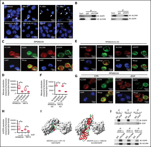 ALCAM interacted with EGFR in myeloma cells. (A) Proximity ligation assay showing ALCAM and EGFR interaction in human MM cell lines (normal RPMI8226, MM1S cells, and ALCAM-KD cells) and primary MM cells (2 of 5) under fluorescence microscopy. The cell nucleus was stained using DAPI (blue). The white arrow points to the site with a positive signal (red spot). Staining EGFR and ALCAM in RPMI8226 cells alone as the negative control. (B) Left: immunoprecipitation of ALCAM and EGFR in RPMI8226 cells, followed by the western blotting of EGFR (top) and ALCAM (bottom), respectively; right: immunoprecipitation of ALCAM and EGFR in RPMI8226 cells, followed by the western blotting of ALCAM (top) and EGFR (bottom), respectively. (C) Confocal fluorescence microscopy analysis of immunofluorescently stained RPMI8226 cells. The y-axis indicates the value of integrated optical density, which could demonstrate the colocalization of ALCAM and EGFR or pEGFR. The data were obtained from 10 randomly choose fields and shown as the mean ± SD. Red, ALCAM; green, EGFR or pEGFR; blue, DAPI for nucleus. (D) Result quantification. (E) Similarly performed experiment as in panel C with RPMI8226-ALCAM- KD cells; results are summarized in panel F. The data were obtained from 3 independent experiments and shown as the mean ± SD. (G) The same immunofluorescence staining of ALCAM and EGFR in MM cells RPMI8226 with or without addition of recombinant EGF (10 ng/mL) for 1 hour. (H) Result quantification. (I) Structure simulation showing the interaction of EGF-EGFR extracellular domain (left) and ALCAM-EGFR extracellular domains (right). EGFR extracellular domain structure is shown in the black and white surface. The higher ZDOCK score indicates higher binding affinity. (J) Top: recombinant EGF (0.5 μg/mL) and EGFR (1 μg/mL) were dissolved in Tris-HCl buffer (pH = 7.4) in the presence of increasing doses of ALCAM-Fc (−, without ALCAM-Fc; +, ALCAM-Fc 0.5 μg/mL; ++, ALCAM-Fc 1 μg/mL), after 30 minutes’ incubation on ice, the mixtures were subjected for immunoprecipitation using αEGF antibody, followed by the western blotting of EGFR and EGF, respectively; bottom: ALCAM-Fc (0.5 μg/mL) and EGFR (1 μg/mL) were dissolved in Tris-HCl buffer (pH = 7.4) in the presence of increasing doses of recombinant EGF (−, without recombinant EGF; +, recombinant EGF 1 μg/mL; ++, recombinant EGF 2 μg/mL), after 30 minutes’ incubation on ice, the mixtures were subjected for immunoprecipitation using αALCAM antibody, followed by the western blotting of EGFR and ALCAM, respectively. All data in bar graphs were assessed by 2-tailed Student t test. *P < .05.