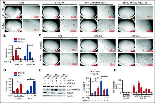 EGF promoted myeloma cells clonogenicity. (A) Imaging of colony-forming assays using RPMI8226 cells (CTR-KD and AL-KD) in the presence of EGF neutralizing antibody (+, EGF neutralizing antibody 10 μg/mL; ++, EGF neutralizing antibody 30 μg/mL). The results are quantified in panel B. (C) Colony-forming assay and (D) statistic result of RPMI8226 (CTR-KD and AL-KD) cells in the presence of recombinant EGF (CTR, without rEGF; +, rEGF 10 ng/mL; ++, rEGF 20 ng/mL). (E) RPMI8226 cells were cultured in CTR-M or BMSC-M in the presence of EGF-neutralizing antibody (10 μg/mL) for 48 hours. The EGFR activation was examined by western blotting for pEGFR (Y1173). The results are quantified in the right panel. (F) EGF concentration in BMSC-M (BMSCs from 3 healthy individuals) and BM aspirations from patients with MM (8 patients) was examined by enzyme-linked immunosorbent assay. (E) Two-tailed Student t test or (B,D) 1-way ANOVA with multiple comparisons. *P < .05, **P < .01.