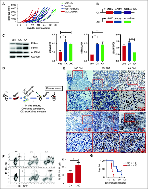 ALCAM suppressed myeloma clonogenicity in vivo in mouse models. (A) Human MM xenograft mouse model was established. Tumor growth after inoculation was examined. (B) Scheme graph showing the CK and AK constructs. (C) western blotting of virus-infected NIH3T3 cell lysates. The results are quantified in the right panel. The data were obtained from 3 independent experiments and shown as the mean ± SD. (D) Scheme graph showing the procedure of adoptive plasma cell cancer model generation. (E) Immunohistochemistry of CD138 in mice BM from non-cancer-bearing mice (NC), CK mice, and AK mice (2 of 5). (F) Flow cytometry analysis of mouse BM cells. The number indicates GFP+/CD138+ cell ratio (left, 2 of 5), and result quantification (right). (G) Mouse survival after adoptive transplantation. All data in bar graphs were assessed by 2-tailed Student t test. *P < .05; **P < .01.