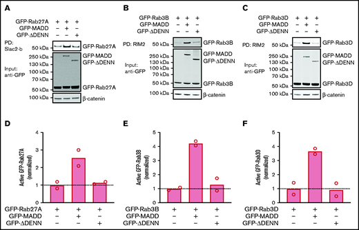 MADD activates secretory Rabs in a DENN domain–dependent manner. HEK293T cells were transfected with GFP-Rab27A (A), GFP-Rab3B (B), or GFP-Rab3D (C) alone or co-transfected with GFP-MADD-full-length or GFP-MADD-ΔDENN. GTP-bound Rabs were extracted from lysates using Slac2-b or RIM2 PD as indicated. GFP-tagged proteins were visualized using an anti-GFP antibody. Experiments were performed in technical duplicates, and representative Western blots are shown. (D-F) Bar graphs represent mean normalized active fractions of Rab27A (D), Rab3B (E), and Rab3D (F) relative to input levels. Dotted lines indicate activity levels in cells transfected with GFP-Rabs without GFP-MADD variants.
