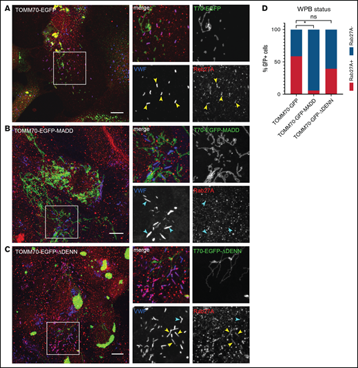 Targeting MADD to mitochondria displaces Rab27A from WPBs. HUVECs were transduced with TOMM70-EGFP (A) or TOMM70-EGFP-MADD (B) or TOMM70-EGFP-MADD-ΔDENN (C) (all shown in green) and immunostained for VWF (blue), Rab27A (red), and VE cadherin (not shown). Boxed areas are magnified on the right. Yellow arrowheads indicate Rab27A+and cyan arrowheads indicate Rab27A– WPBs. Scale bars represent 10 µm. (D) Quantification of the percentage of transduced (GFP+) HUVECs containing Rab27A+ WPBs in TOMM70-EGFP (175 cells analyzed), TOMM70-EGFP-MADD (96 cells analyzed), and TOMM70-EGFP-MADD-ΔDENN (38 cells analyzed). Data are shown as mean and were analyzed by using one-way ANOVA with Dunnet’s multiple comparisons test. *P < .05.