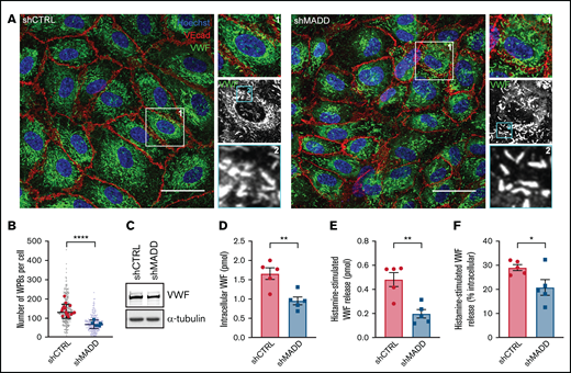 MADD promotes VWF secretion in endothelial cells. (A) HUVECs were transduced with shCTRL or shMADD and immunostained for VWF (green), vascular endothelial cadherin (VEcad) (red) and nuclei (blue). Boxed areas are magnified on the right (1) and below (2). Scale bars represent 10 µm. (B) The number of WPBs was quantified per cell (small dots) and averaged per image (large dots) in 15 shCTRL and 6 shMADD images. (C) Western blot analysis for VWF expression in shCTRL- and shMADD-transduced HUVECs. Data from enzyme-linked immunosorbent assay (ELISA) show (D) intracellular VWF content in unstimulated cells, (E) 30-minute histamine-stimulated VWF secretion in absolute amounts (expressed in pmol), and (F) as a percentage of intracellular content of resting or nonstimulated cells (data are from 5 biological replicates). (D-F) Data are shown as mean ± SEM and were analyzed by using an unpaired Student t test. *P < .05; **P < .01; ****P < .0001.
