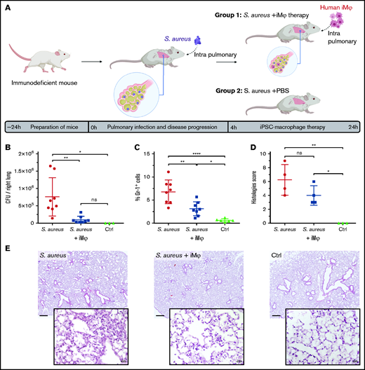 Therapeutic effect of adoptively transferred iMφs in pulmonary infected immunodeficient mice. (A) Scheme of pulmonary infection and therapeutic transplantation of iMφs in hIL-3/GM-CSF KI immunodeficient mice. Animals were infected by intrapulmonary administration of 1 × 107 CFU of S aureus Newman. Four hours postinfection, the treatment group received 4 × 106 human iMφs intrapulmonary (S aureus+iMφ), whereas control mice received PBS (S aureus+PBS). (B) CFU per right lung and (C) frequency of murine monocyte/granulocyte (mGr-1+ cells) infiltration 24 hours postinfection (data from 2 independent experiments, individual values and mean ± SD, 3-8 animals/group). (D) Histopathology scores of the left lung tissue 24 hours postinfection (individual values and mean ± SD) and (E) representative microscopy images of hematoxylin-eosin staining of the lung tissue (original magnification ×2.5 for the top and ×40 for the bottom rows, scale bar = 500 and 20 µm, respectively). *P < .05; **P < .01; ****P < .0001; ns, not significant, as determined by 1-way ANOVA with Tukey’s multiple comparisons test.